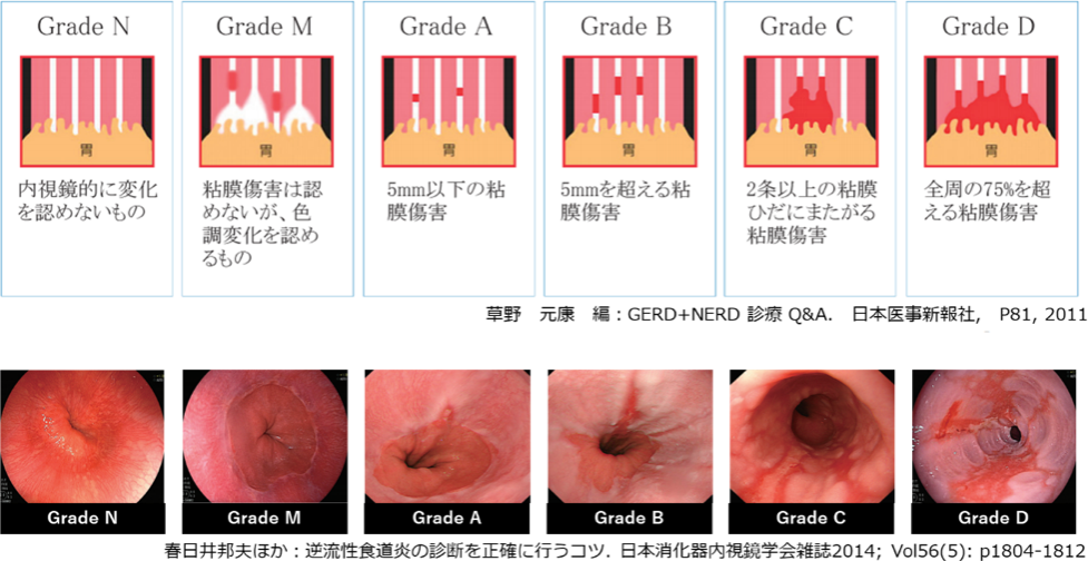 ストレスを管理するためのヒント